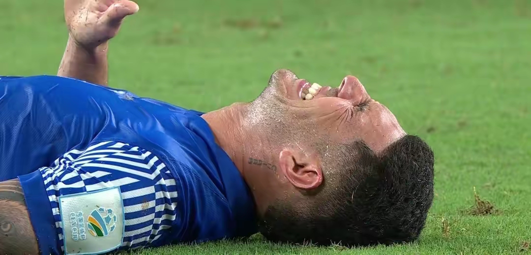 乐鱼官网-足总杯倒计时，切尔西清晨伤情更新，细节引发关注，更衣室稳定，纪律约束更严格的简单介绍